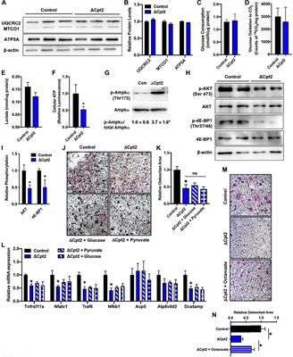 Mitochondrial fatty acid β-oxidation is important for normal osteoclast formation in growing female mice